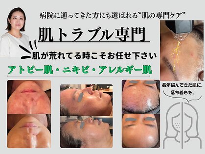 アーブル(Agreable)の写真