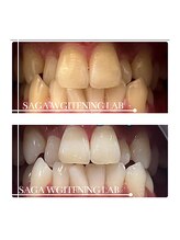 佐賀ホワイトニングラボ/