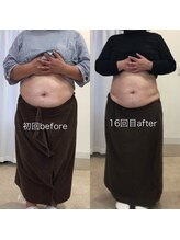 ジョワイユ(Joyeux)/腸の位置でお腹は変わる