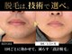 ダイヤ 名古屋中川区店(Daiya)の写真/【症例数エリアNo.1】少ない回数で卒業を目指す、技術で選ぶ大人のメンズ脱毛。|ヒゲ・VIO特化!
