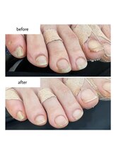 ネイルアトリエ ボン(nail atelier bon)/フットネイルケア