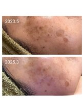 シシラ(shishira)/長年のお悩みに