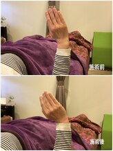 ヴィラ整骨院/手首痛み改善に◎