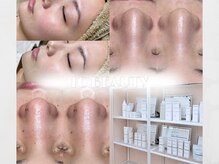 アイシービューティー(IC BEAUTY)の雰囲気（人気のハーブピーリングでニキビ・毛穴ケア◎）