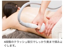 Beauty Cafe TWIN V【ネイル／エステ】の雰囲気（痩身機器(マジックポット) ）