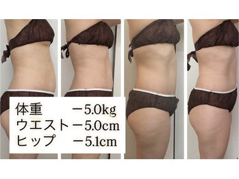 ラブランフェアリーの写真/サイズダウンへ導く！結果重視の部分集中ケアとデトックスで理想のボディラインへ◎