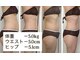 ラブランフェアリーの写真/サイズダウンへ導く！結果重視の部分集中ケアとデトックスで理想のボディラインへ◎