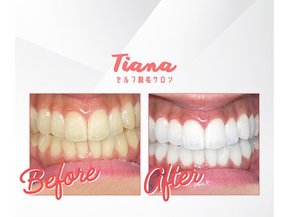 ティアナ 神栖店(Tiana)の写真