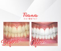 ティアナ 神栖店(Tiana)