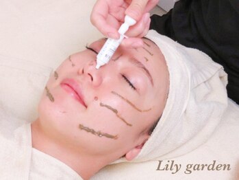 リリーガーデン(Lily Garden)/最新☆HARI美容!