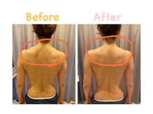 クレビア 麻布十番(CREBIA)/上半身のむくみをスッキリ！！