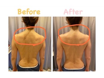 クレビア 麻布十番(CREBIA)/上半身のむくみをスッキリ！！