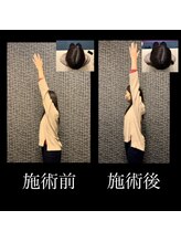 カラダラボ(Karada LAB)/Before After