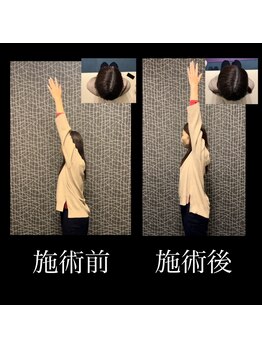 カラダラボ(Karada LAB)/Before After