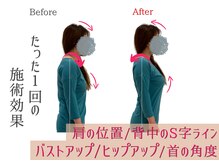 小顔製作所 心斎橋院/肩幅矯正　解説１