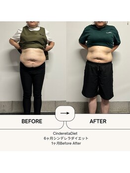 オーシャン整骨院(OCEAN整骨院)/6ヶ月コース