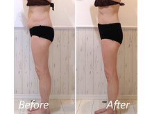 ドクターボディ 新宿店(Dr.Body)/更年期のポッコリお腹もお任せ☆