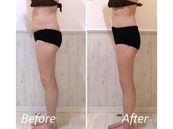 ドクターボディ 新宿店(Dr.Body)/更年期のポッコリお腹もお任せ☆