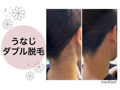 トゥルーカインド(true kind)の写真