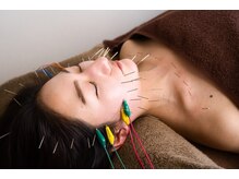 摩擦を一切加えずに肌血流をよくできるのは電気美容鍼だけ