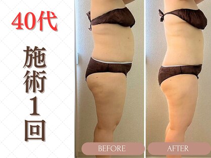 ミヨンドットビー(miyong.B)の写真