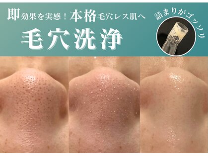 ベストベル(BestBelle)の写真