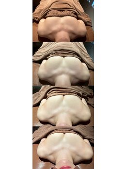 ロココ 豊田店(Rococo)/ビフォーアフター