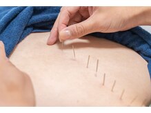 フラット柏(FLAT柏)/自律神経の不調には鍼がおすすめ