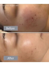 パールプラス 小牧店(Pearl plus)/BeforeAfter