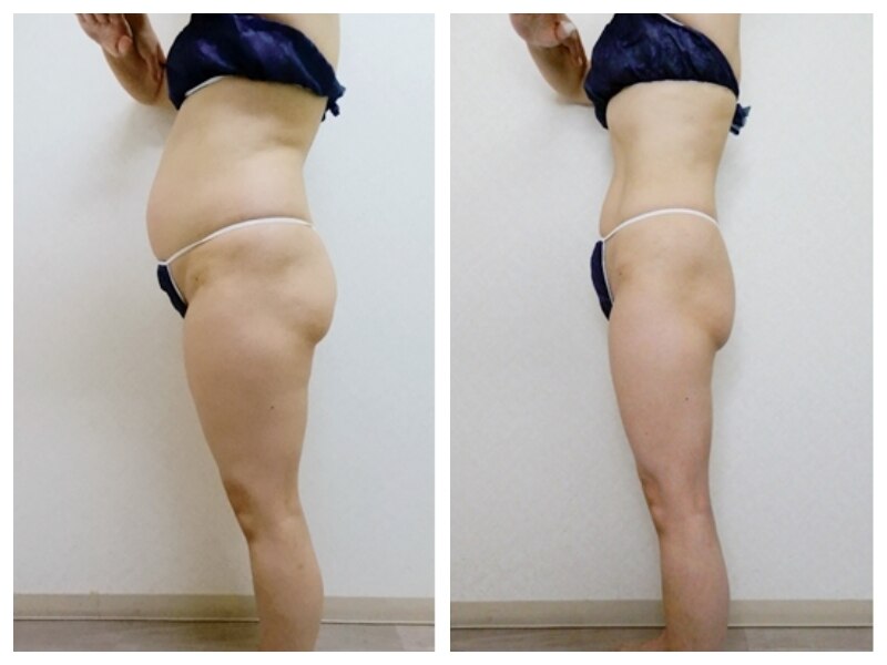 C038186531.jpg?impolicy=