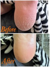 リゼラアンドコー 茂原店/かかとのガサガサケアできます