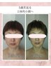 ☆毛穴洗浄＋【たるみケア立体的小顔＆艶肌作り】最強小顔整顔＋EMS