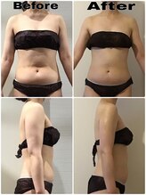 クリスタルビューティー/30代