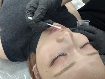 ラリール(Larire)の写真/遂に岐阜上陸!【最新韓国美容◆ローマピンク¥99000/専用クリーム３本付】長年の黒ずみ悩みをサクッと解消♪