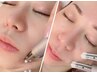年齢サインに≪目元・口元+肌ツヤＵＰ◎≫表情筋リフティング×導入＆洗浄♪