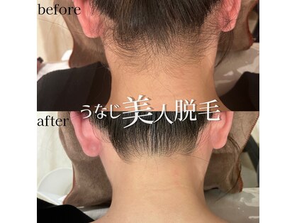 メルシートータルビューティー(MERCI)の写真