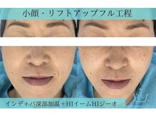 リメイク 広尾(REMAKE)/