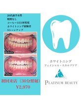 プラチナムビューティ 渋谷店(PLATINUM Beauty)/セルフホワイトニング