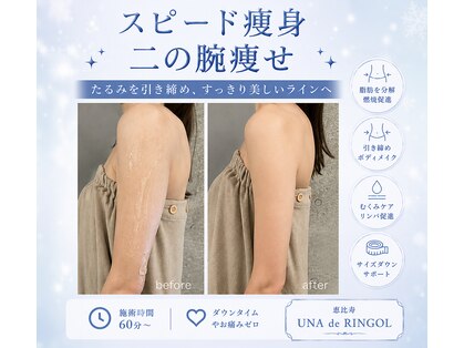ウナ デ リンゴル 恵比寿店(UNA de Ringol)の写真