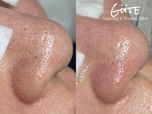 ギューテ(Gute)の雰囲気（人気の毛穴洗浄とセットで毛穴のお悩み改善。）