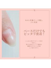 ロータス(LOTUS)/ネイル卒業も！