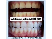 ホワイトニングサロン ホワイト(WHITE)/セルフホワイトニング/大阪/福島