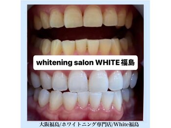 ホワイトニングサロン ホワイト(WHITE)/セルフホワイトニング/大阪/福島