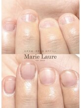 マリーロール 天王寺店(Marie Laure)/自爪育成/深爪矯正/ネイルケア