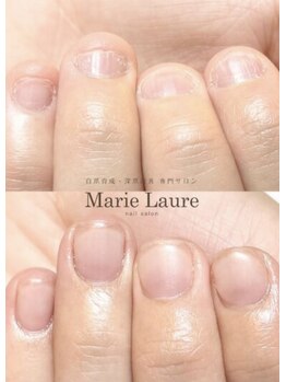 マリーロール 天王寺店(Marie Laure)/自爪育成/深爪矯正/ネイルケア