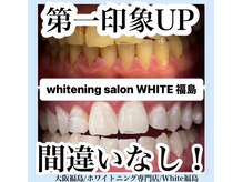 ホワイトニングサロン ホワイト(WHITE)/セルフホワイトニング/大阪/福島