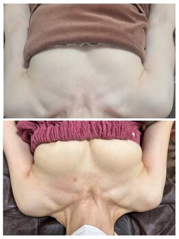 イベリス(IBERIS.)/当店ビフォーアフター