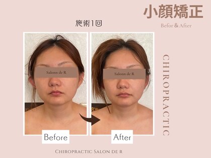 カイロプラクテックサロンドアール(Salon de R)の写真