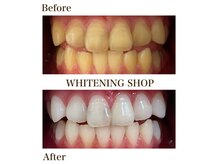 ホワイトニングショップ 恵比寿店の雰囲気（☆before＆after★）