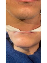 メンズサロン エイチ(H)/